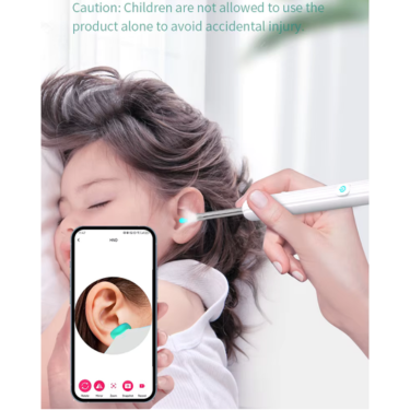 "Smart Visual Ear Cleaner"